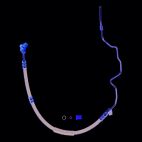 Power Steering Pressure Hose